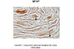 Sample Type :  Mouse sciatic nerve  Primary Antibody Dilution :  1:500  Secondary Antibody :  Biotinylated Anti-Rabbit 1:1000 followed by avidin-biotin and diaminobenzidine  Secondary Antibody Dilution :  1:1000  Gene Name :  MFAP4  Submitted by :  Beth Friedman, Ph. (MFAP4 antibody  (N-Term))