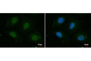 ICC/IF Image PSKH2 antibody [N2C3] detects PSKH2 protein at nucleus by immunofluorescent analysis. (PSKH2 antibody)