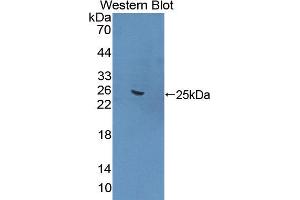 Western blot analysis of the recombinant protein. (FNBP1 antibody  (AA 348-529))