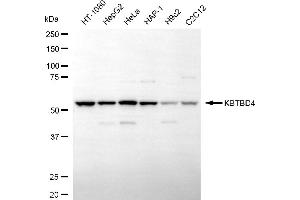 anti-Kelch Repeat and BTB (POZ) Domain Containing 4 (KBTBD4) antibody