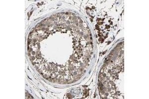 Immunohistochemical staining (Formalin-fixed paraffin-embedded sections) of human testis with CHST9 polyclonal antibody  shows strong cytoplasmic positivity in Leydig cells, cells in seminiferous ducts were moderately stained at 1:200-1:500 dilution. (CHST9 antibody)