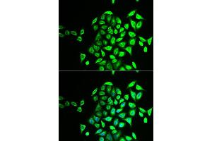 Immunofluorescence analysis of U2OS cell using NAPG antibody. (NAPG antibody)