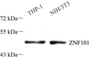 Western blot analysis of ZNF101 (ABIN7076259) at dilution of 1: 1000