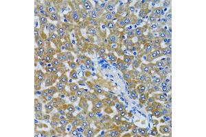 Immunohistochemistry of paraffin-embedded rat liver using HDAC5 antibody. (HDAC5 antibody)