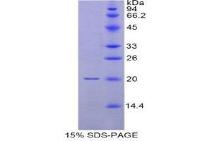 SDS-PAGE (SDS) image for Myosin Regulatory Light Chain 2, Smooth Muscle Isoform (MYL9) (AA 5-163) protein (His tag) (ABIN1877390) (MYL9 Protein (AA 5-163) (His tag))