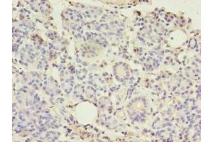 Immunohistochemistry of paraffin-embedded human pancreatic tissue using ABIN7148290 at dilution of 1:100 (TMEM27 antibody  (AA 15-141))