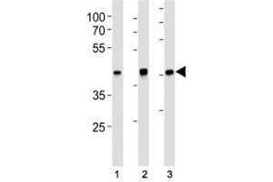 TBP antibody