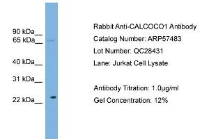 WB Suggested Anti-CALCOCO1  Antibody Titration: 0. (CALCOCO1 antibody  (N-Term))