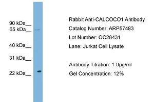WB Suggested Anti-CALCOCO1  Antibody Titration: 0.