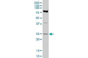 RAN polyclonal antibody (A01), Lot # 050921JC01 Western Blot analysis of RAN expression in Hela S3 NE . (RAN antibody  (AA 1-216))