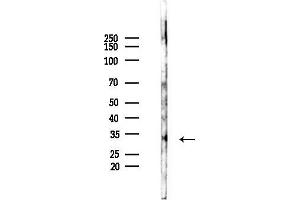 anti-Paired-Like Homeodomain 1 (PITX1) (Internal Region) antibody