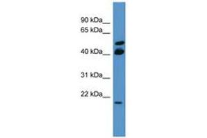 Image no. 1 for anti-RAS-Like, Estrogen-Regulated, Growth Inhibitor (RERG) (C-Term) antibody (ABIN6746640) (RERG antibody  (C-Term))