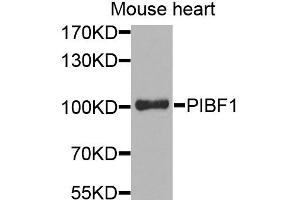 Western blot analysis of extracts of mouse heart, using PIBF1 antibody.