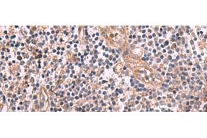 Immunohistochemistry of paraffin-embedded Human tonsil tissue using MGP Polyclonal Antibody at dilution of 1:75(x200) (MGP antibody)