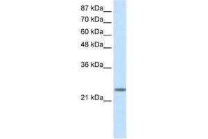 Western Blotting (WB) image for anti-MAX Dimerization Protein 3 (MXD3) antibody (ABIN2460166)
