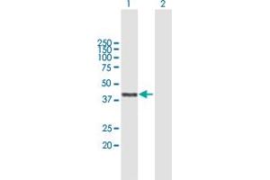 Western Blot analysis of ATAD2 expression in transfected 293T cell line by ATAD2 MaxPab polyclonal antibody. (ATAD2 antibody  (AA 1-362))