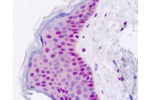 Human, Skin; Formalin-Fixed Paraffin-Embedded (FFPE) (DIS3 antibody  (AA 295-323))