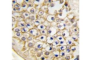 IHC analysis of FFPE human testis tissue stained with TRPV3 antibody