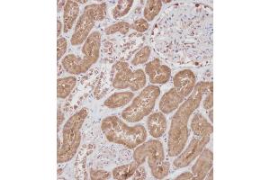 Immunohistochemistry (Paraffin-embedded Sections) (IHC (p)) image for anti-Ribosomal Protein S18 (RPS18) (AA 62-91) antibody (ABIN390874)