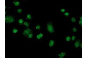 Anti-FKBPL mouse monoclonal antibody (ABIN2454034) immunofluorescent staining of COS7 cells transiently transfected by pCMV6-ENTRY FKBPL (RC202153). (FKBPL antibody)