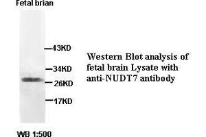 Image no. 2 for anti-Nudix (Nucleoside Diphosphate Linked Moiety X)-Type Motif 7 (NUDT7) antibody (ABIN791186) (NUDT7 antibody)