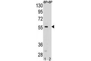 SMAD5 antibody pre-incubated without (lane 1) and with (2) blocking peptide in HeLa lysate. (SMAD5 antibody  (AA 241-269))
