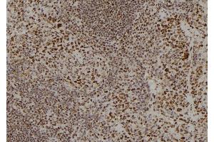 ABIN6259986 and ABIN6278790 at 1/100 staining Mouse spleen tissue by IHC-P. (APOBEC3C antibody  (C-Term))