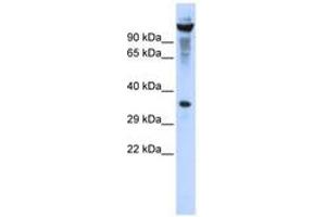 Image no. 1 for anti-Ribonuclease T2 (RNASET2) (AA 107-156) antibody (ABIN6740327) (RNASET2 antibody  (AA 107-156))