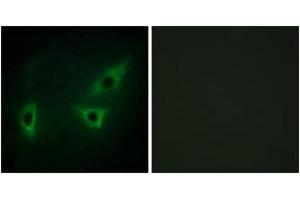 Immunofluorescence analysis of HeLa cells, using ATP7B Antibody.