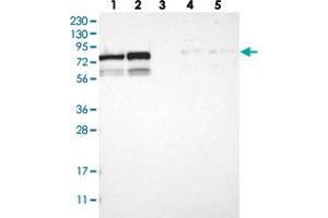 Western blot analysis of Lane 1: RT-4, Lane 2: U-251 MG, Lane 3: Human Plasma, Lane 4: Liver, Lane 5: Tonsil with MTA2 polyclonal antibody  at 1:250-1:500 dilution. (MTA2 antibody)
