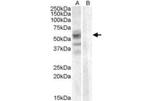 ARSD polyclonal antibody  (0. (Arylsulfatase D antibody)