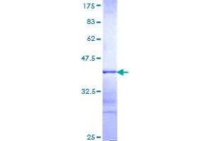 MYST Histone Acetyltransferase (Monocytic Leukemia) 3 (MYST3) (AA 81-179) protein (GST tag)