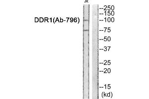 Western Blotting (WB) image for anti-Discoidin Domain Receptor tyrosine Kinase 1 (DDR1) (Tyr796) antibody (ABIN1848398) (DDR1 antibody  (Tyr796))