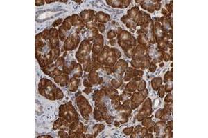 Immunohistochemical staining of human pancreas with HDLBP polyclonal antibody  shows strong cytoplasmic positivity in exocrine glandular cells.