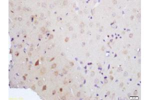Formalin-fixed and paraffin embedded rat brain tissue labeled with Rabbit Anti-Vitamin D3 Receptor Polyclonal Antibody, Unconjugated (ABIN2559664) at 1:200 followed by conjugation to the secondary antibody and DAB staining (Vitamin D Receptor antibody  (AA 51-150))