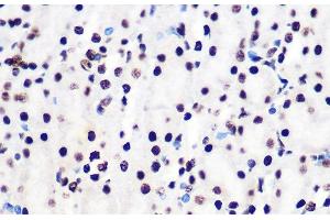 Immunohistochemistry (Paraffin-embedded Sections) (IHC (p)) image for anti-SMAD, Mothers Against DPP Homolog 2 (SMAD2) (pSer423), (pSer425), (pSer465), (pSer467) antibody (ABIN7265256)