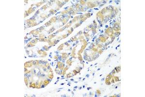 Immunohistochemistry of paraffin-embedded human stomach using MSRB2 antibody at dilution of 1:100 (40x lens).