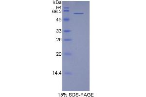 SDS-PAGE (SDS) image for Telomeric Repeat Binding Factor (NIMA-Interacting) 1 (TERF1) (AA 148-428) protein (His tag,GST tag) (ABIN1877809)