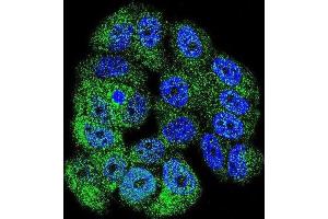 Immunofluorescence (IF) image for anti-C-Abl Oncogene 1, Non-Receptor tyrosine Kinase (ABL1) antibody (ABIN3003438) (ABL1 antibody)