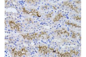 Immunohistochemistry of paraffin-embedded rat kidney using GGT1 antibody (ABIN1872809) at dilution of 1:100 (40x lens). (GGT1 antibody)