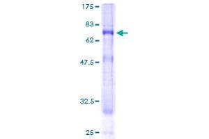 Image no. 1 for Phosphatidylinositol Glycan Anchor Biosynthesis, Class O (PIGO) (AA 1-454) protein (GST tag) (ABIN1315027) (PIGO Protein (AA 1-454) (GST tag))