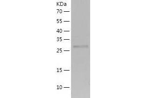 Western Blotting (WB) image for 3-hydroxyanthranilate 3,4-Dioxygenase (HAAO) (AA 1-286) protein (His tag) (ABIN7121609) (HAAO Protein (AA 1-286) (His tag))