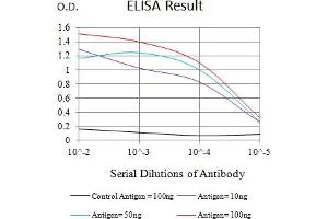 Black line: Control Antigen (100 ng),Purple line: Antigen (10 ng), Blue line: Antigen (50 ng), Red line:Antigen (100 ng) (IL5RA antibody  (AA 21-196))