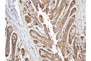 IHC-P Image Immunohistochemical analysis of paraffin-embedded human colon , using NDUFA10, antibody at 1:100 dilution. (NDUFA10 antibody  (Center))