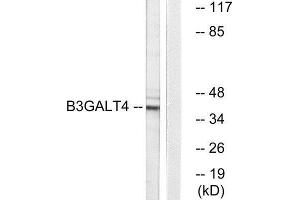 Western Blotting (WB) image for anti-UDP-Gal:betaGlcNAc beta 1,3-Galactosyltransferase, Polypeptide 4 (B3GALT4) (Internal Region) antibody (ABIN1850898)