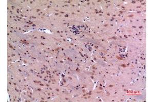 Immunohistochemistry (IHC) analysis of paraffin-embedded Rat Brain, antibody was diluted at 1:100. (GDI2 antibody  (C-Term))