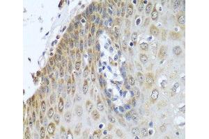 Immunohistochemistry of paraffin-embedded Human esophagus using POR Polyclonal Antibody at dilution of 1:100 (40x lens). (POR antibody)