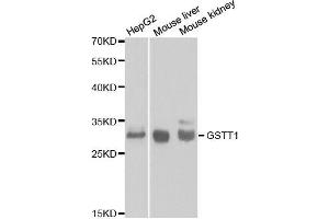 Western blot analysis of extracts of various cell lines, using GSTT1 antibody.