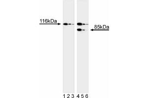 Western blot analysis of PARP. (PARP1 antibody)