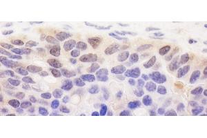 anti-Spermatogenesis Associated 2 (SPATA2) (AA 250-300) antibody